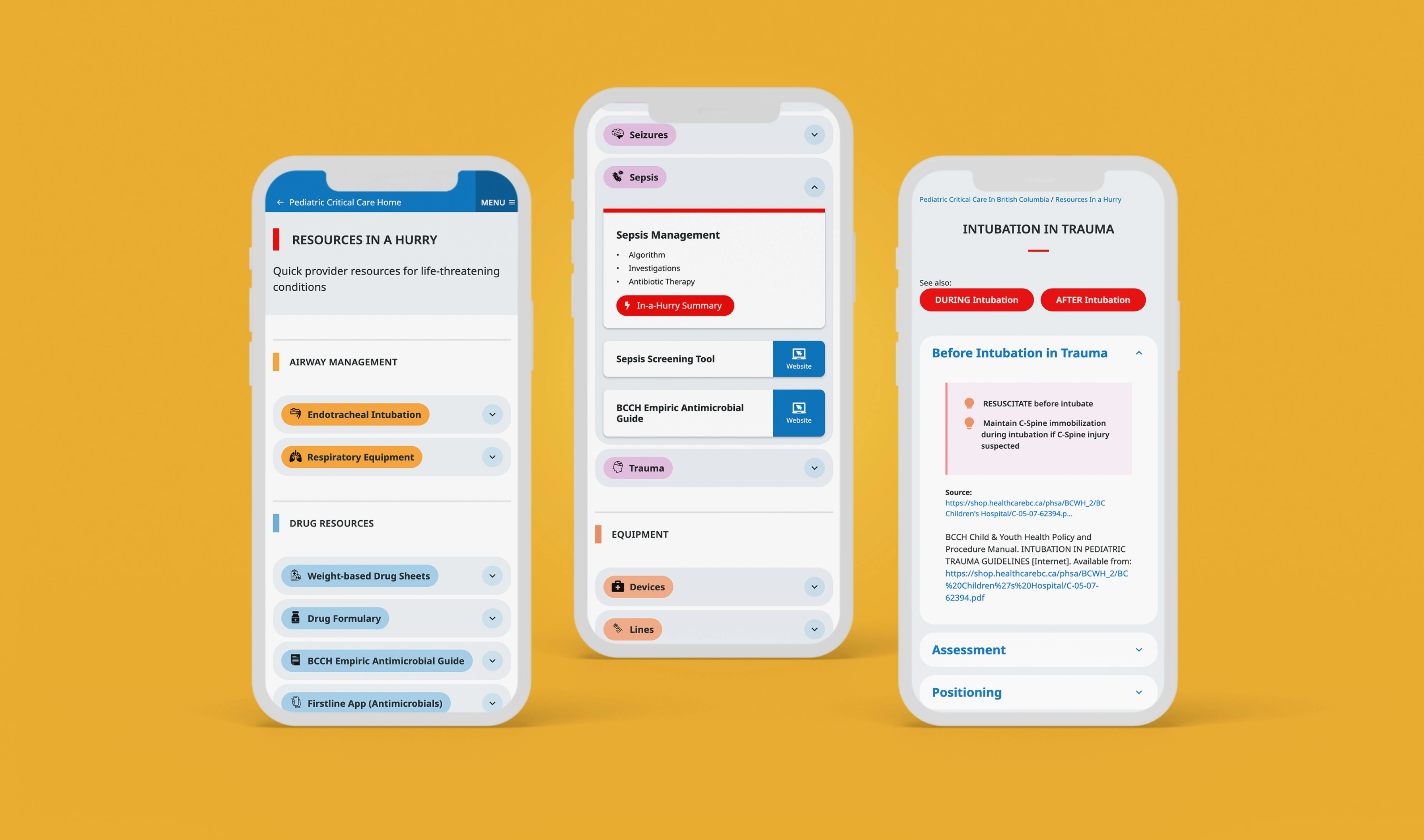 The Pediatric Critical Care website mocked up on 3 phones. Showing resource section, and resource detail pages such as sepsis management and intubation in trauma. 